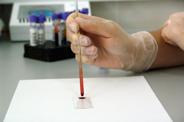 Nie wiadomo, czy wynik pozytywny dały testy na koronawirusa przeprowadzone już w Białymstoku, gdzie przeprowadzane są od poniedziałku. Wcześniej próbki były wysyłane do Warszawy. (fot. pixabay.com)