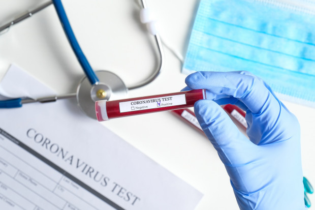 Walka z epidemią koronawirusa mocno ekploatuje zasoby służby zdrowia (fot. Shutterstock.com)