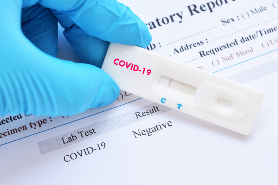 COVID-19: test antygenowy można wykonać w 64 aptekach; zgłaszają się kolejne