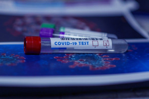 Koronawirus 2 października: 4619 zakażeń koronawirusem, 33 przypadki śmierci z powodu COVID-19 (fot. pixabay)