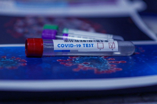 28 zakażeń koronawirusem, nie zanotowano zgonów osób z COVID-19 (fot. pixabay)